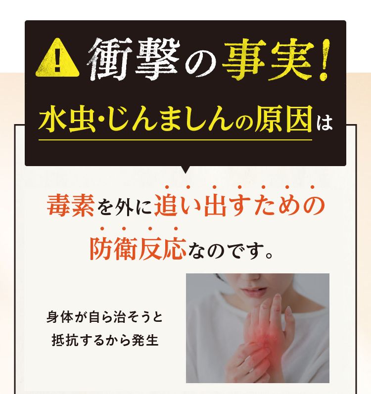 衝撃の事実！じんましんの原因は毒素を外に追い出すためにの防衛反応なのです。